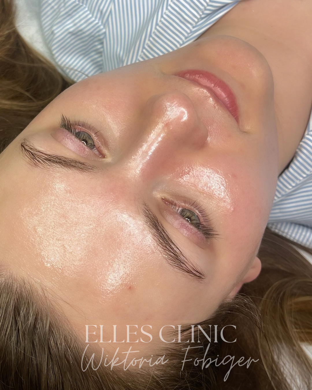 Efekt zabiegu rozświetlającego twarz – gładka, promienna i wyrównana skóra